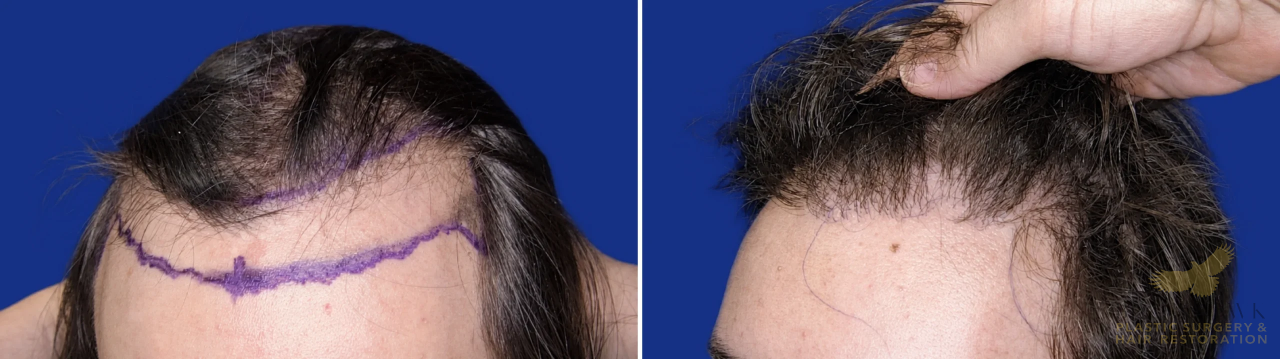 View • Before | After