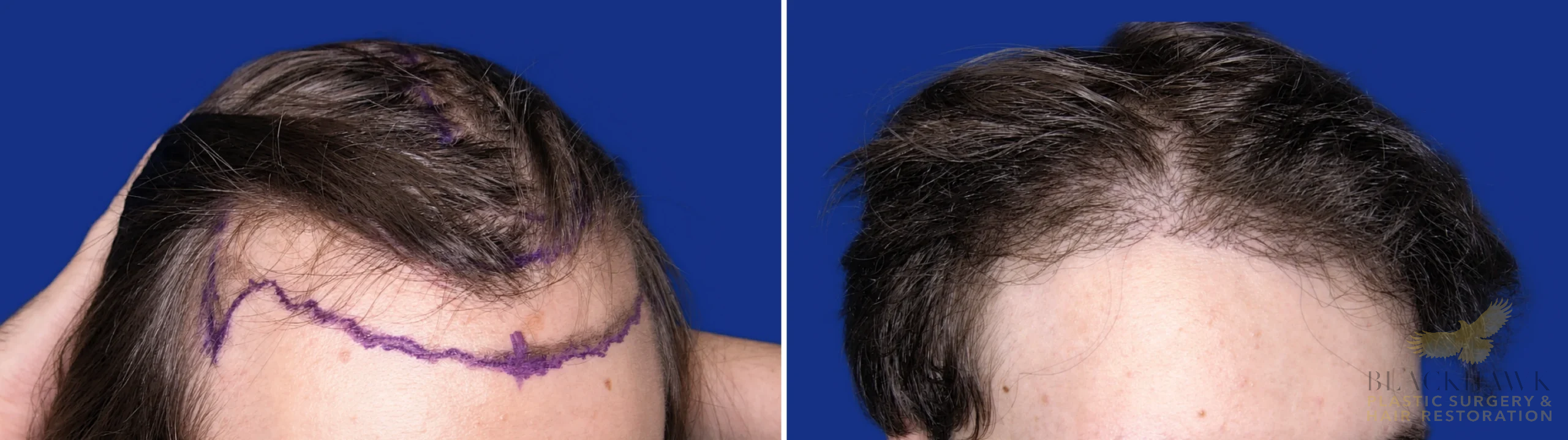 View • Before | After