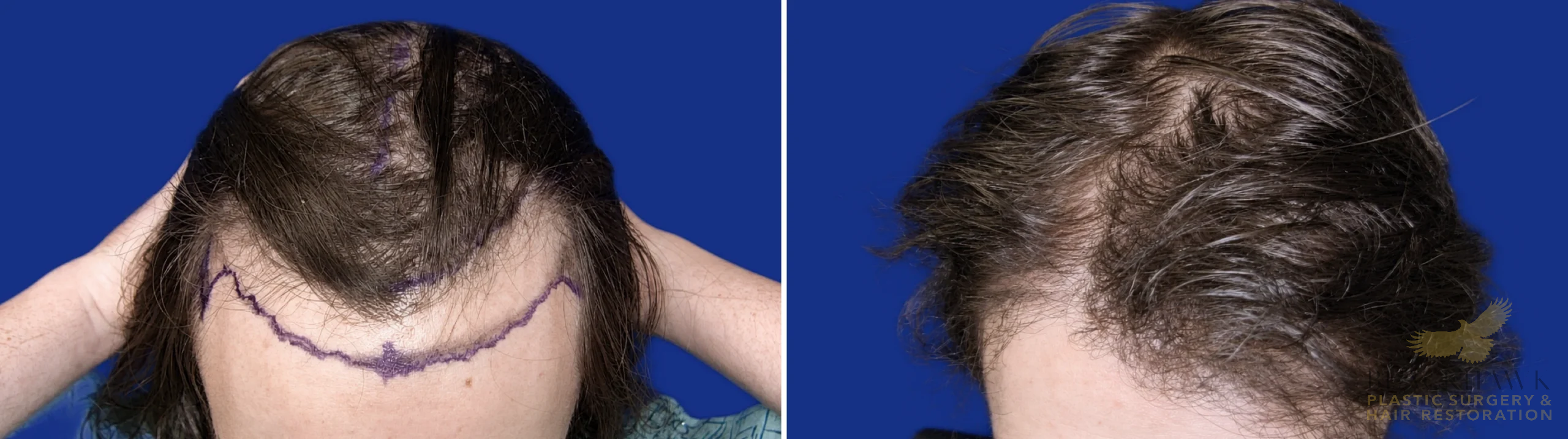 View • Before | After