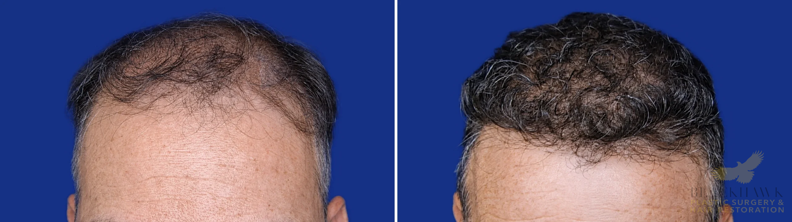 View • Before | After
