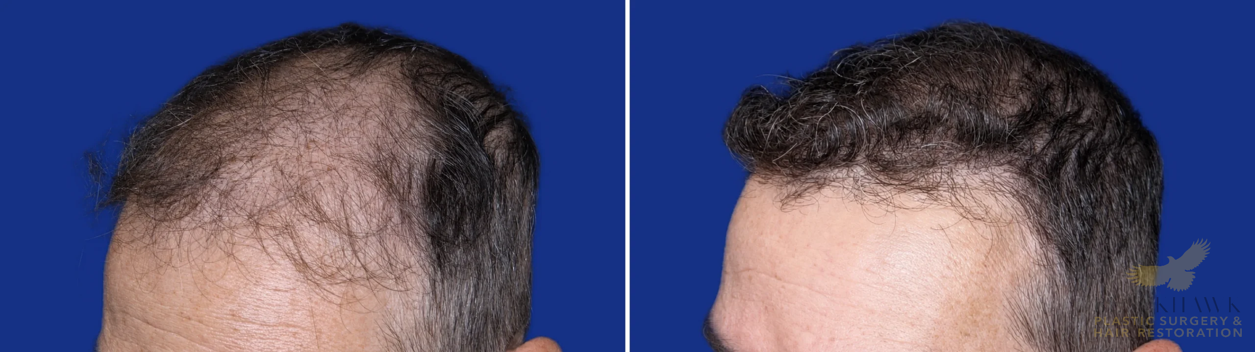 View • Before | After