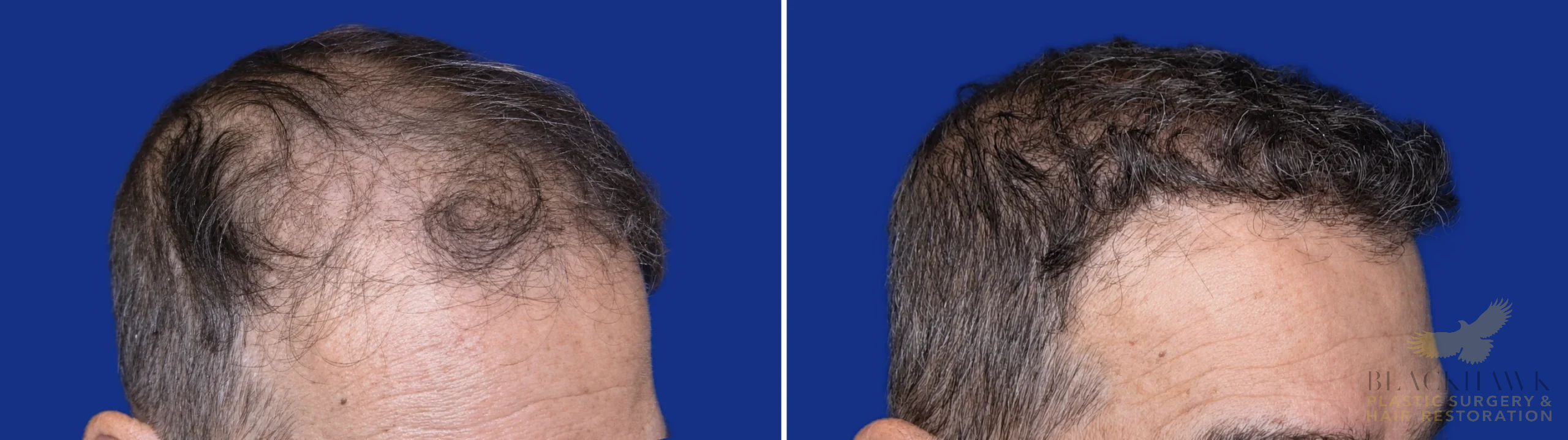 View • Before | After