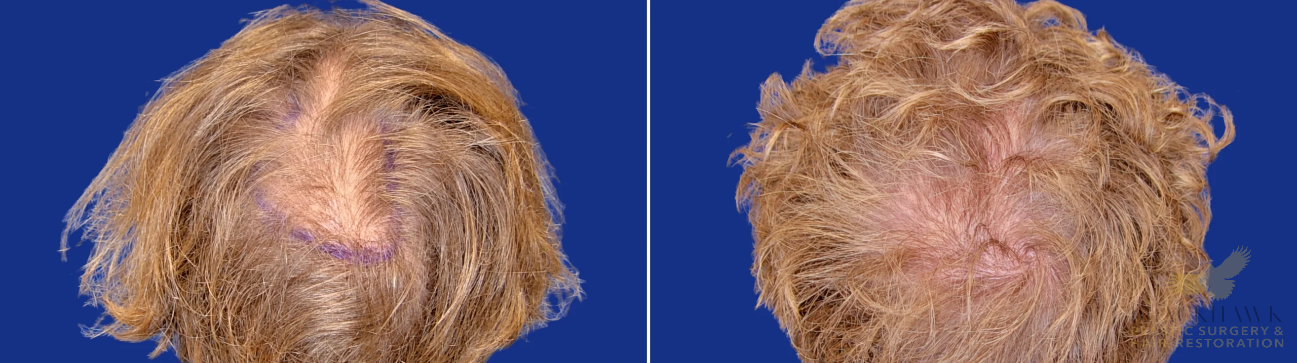 View • Before | After